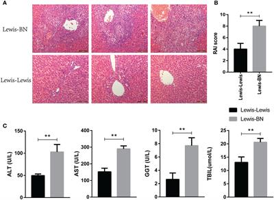 Transcriptomic analysis of graft liver provides insight into the immune response of rat liver transplantation